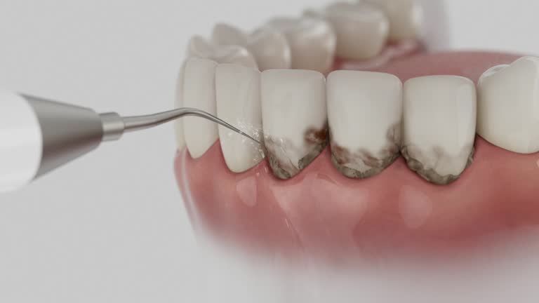 Trusted Dental Implants service in Highlands, TX - Dentist Open Now